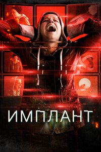 Имплант (фильм, 2021)